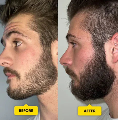 Side-by-side comparison of a man’s beard before and after using beard care products