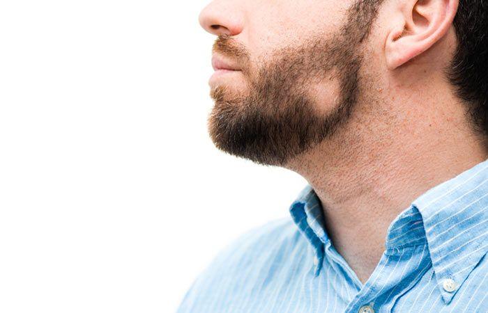 Close-up of a man's face with patchy beard and uneven facial hair growth
