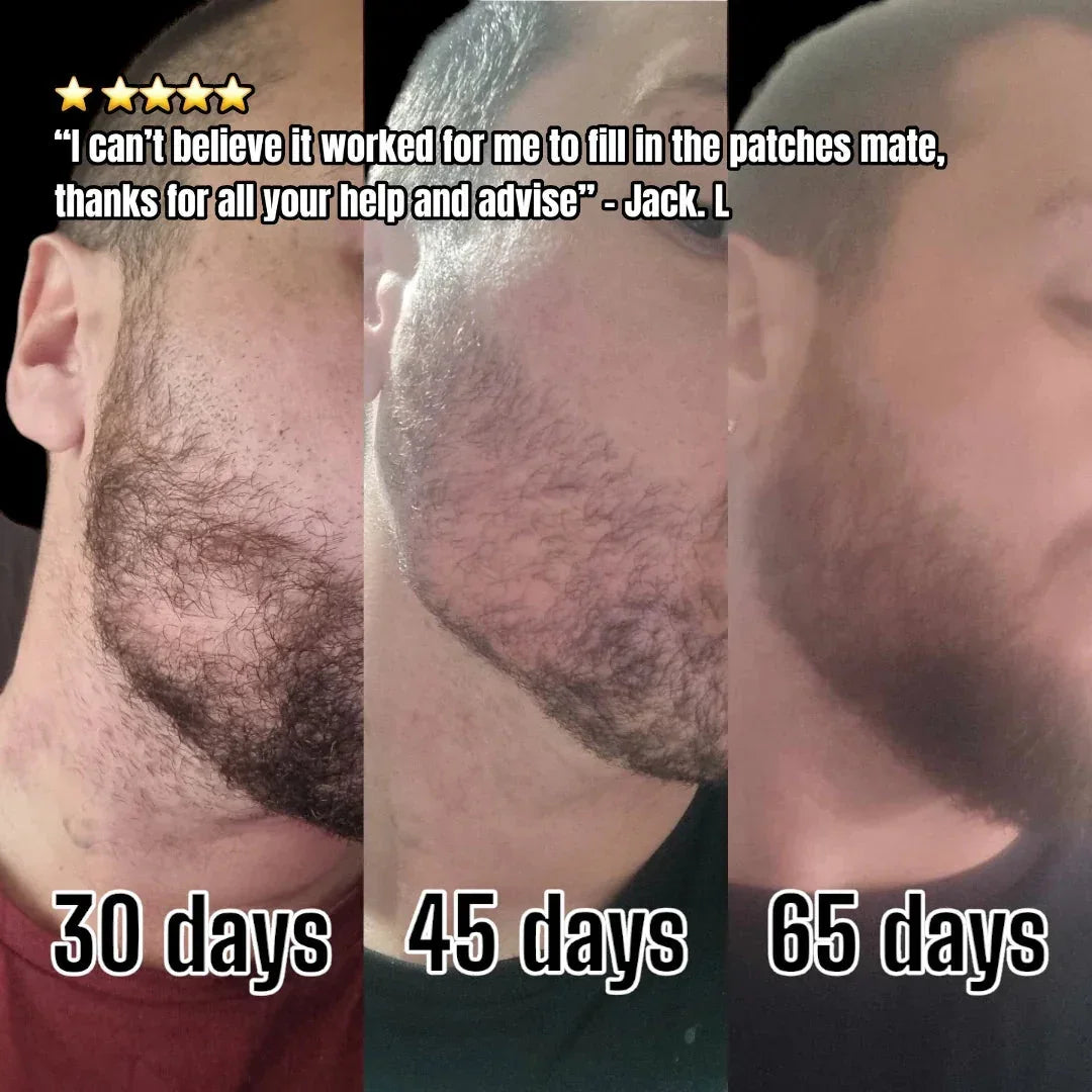 Beard growth before and after comparison over 30, 45, and 65 days, Hairy Man Care testimonial.