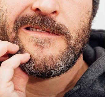 Man scratching his itchy beard, close-up of dry facial hair and irritated skin
