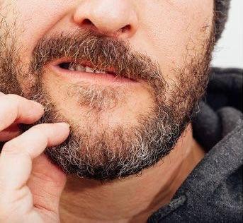 ITCHY BEARD | PRODUCT FOR ITCHY BEARD | BEARD BUTTER | HOW TO STOP ITCHY BEARD