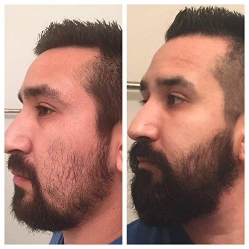 Beard Growth Kit - Hairy Man Care
