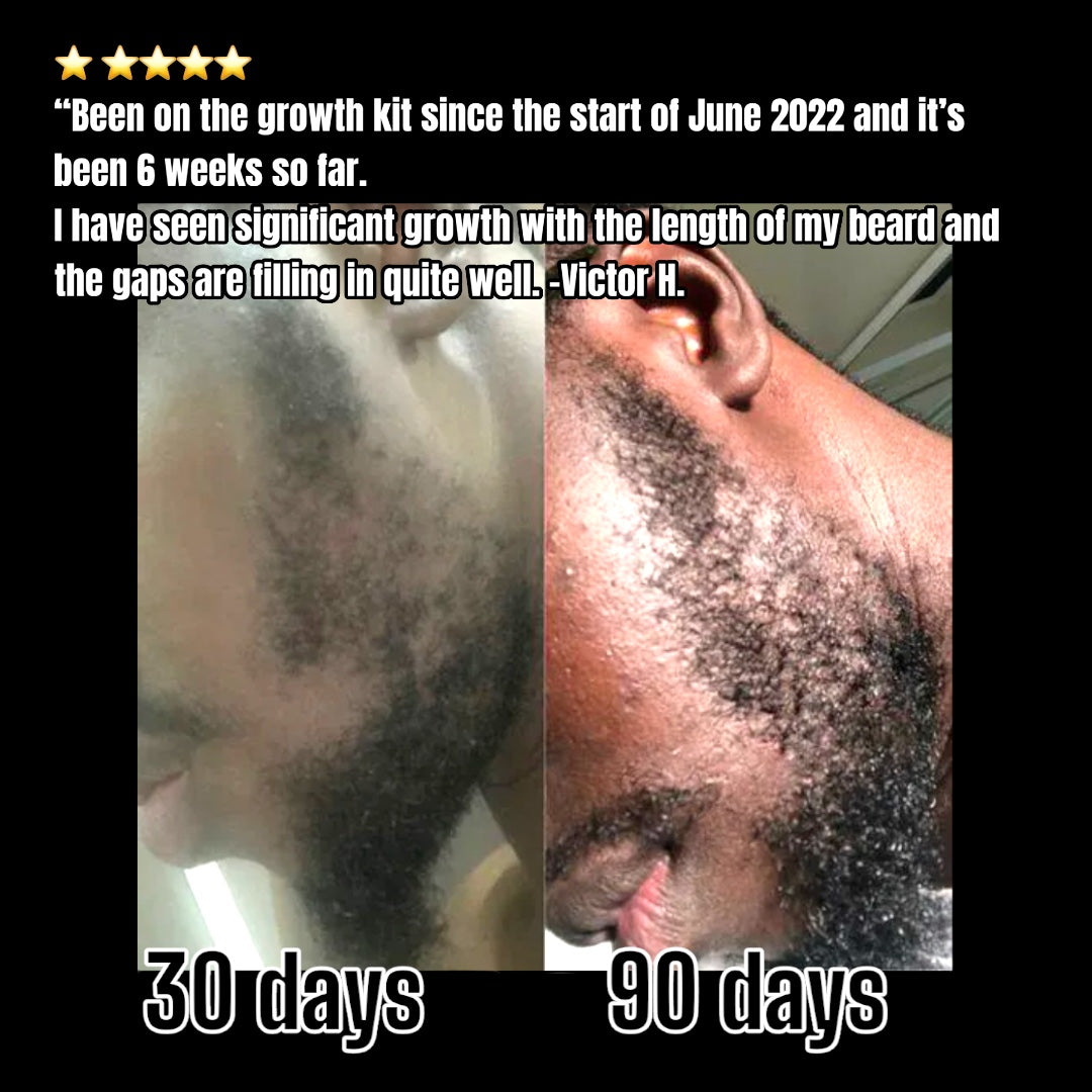 Beard-Growth-Kit-Australia
