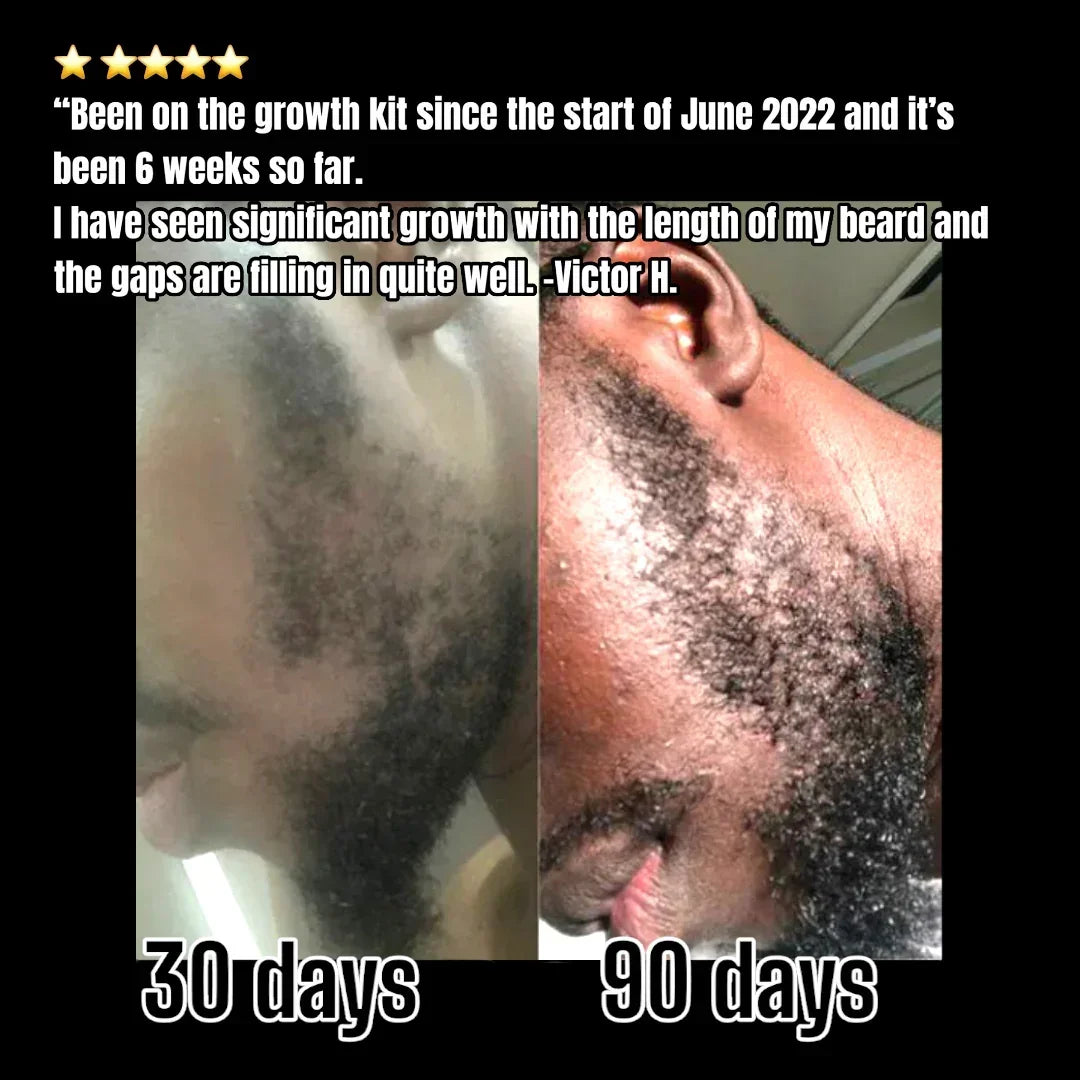 Beard growth kit before and after 30 days vs 90 days results, Hairy Man Care testimonial