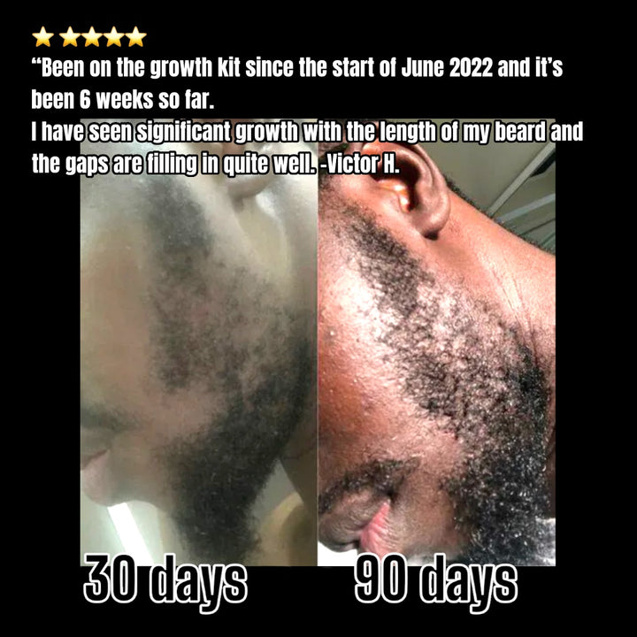 Beard-Growth-Kit-Australia