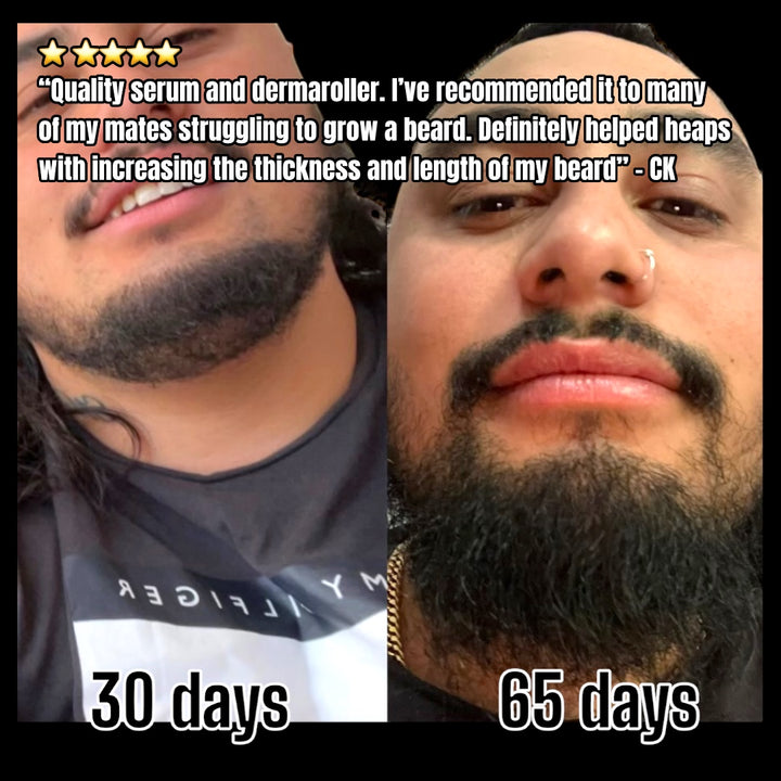 Beard Growth Kit - Hairy Man Care